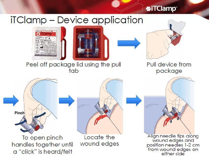 iTClamp Пристрій прямого тиску для зупинки кровотеч 293-07c фото